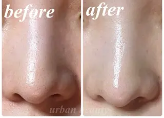 結果重視｜毛穴エステ ｜友綱理恵のエステ・リラクイメージ