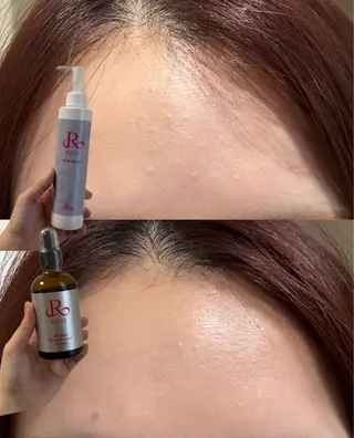 メンズ laksmi 本気の肌改善サロンのエステ・リラクイメージ