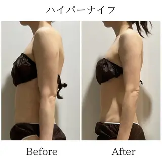 LiLL by Andre beauty所属・LiLL 熊本のエステ・リラクイメージ