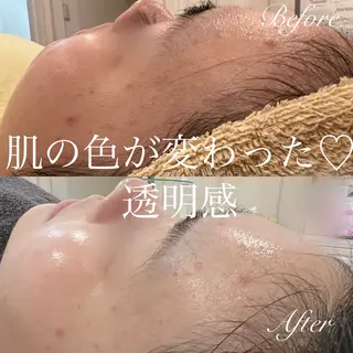 miki 東根の肌質改善サロンのエステ・リラクイメージ