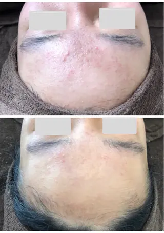 肌質改善サロン La Divinaのエステ・リラクイメージ