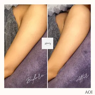 salon shares 辻堂店所属・SHARES AOIのエステ・リラクイメージ