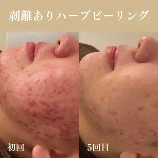 Oncebell. Bodymake&beautysalon所属・Oncebell. ワンベルのエステ・リラクイメージ