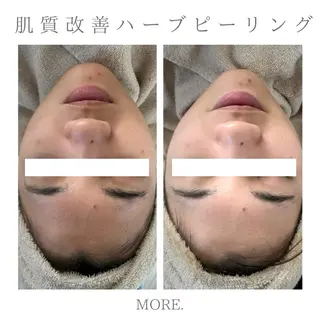 MORE. NEMAのエステ・リラクイメージ