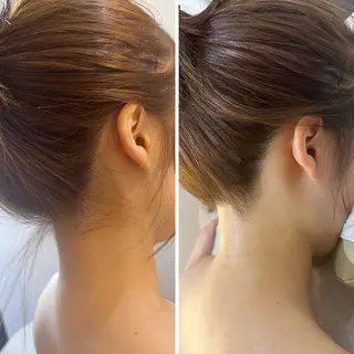 うなじ脱毛/美肌脱毛 LABELのエステ・リラクイメージ