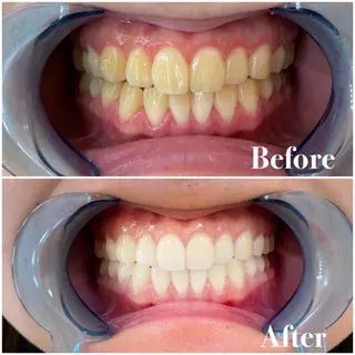 セミロング パーマ キッズ アイブロウ マツエク・マツパ メンズ カラー ヘアアレンジ ネイル ライトビューティー 銀座店のエステ・リラクイメージ