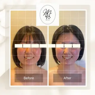 MeguruSalon所属・山口 颯希のエステ・リラクイメージ