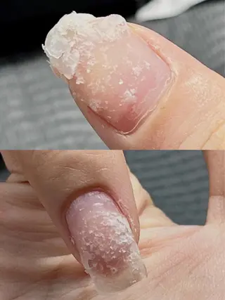 ネイル BETTER ME ネイルサロン池田公園のネイルデザイン