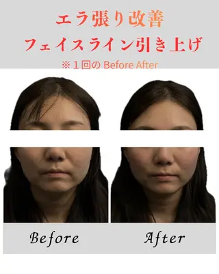 Re mのエステ・リラクイメージ