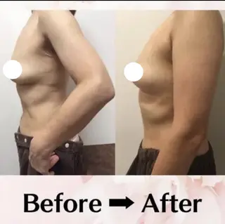 バスト・脱毛・痩身 上島のエステ・リラクイメージ