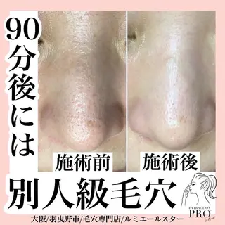 シミケア放題専門 /杉原いくえのエステ・リラクイメージ