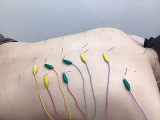 まごころ鍼灸整骨院所属・まごころ鍼灸整骨院 京王堀之内院のエステ・リラクイメージ