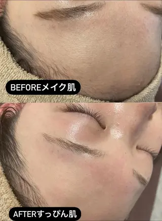 アイブロウ キッズ メンズ Epina 千葉店 【エピナ】のエステ・リラクイメージ