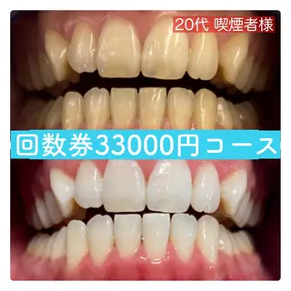 PLATINUM Beauty 横浜店所属・ホワイトニングルーム 横浜店のその他イメージ