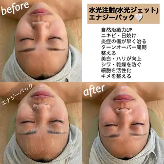 うなじ脱毛/美肌脱毛 LABELのエステ・リラクイメージ