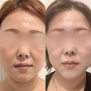 エステサロンLea所属・エステサロン Leaのエステ・リラクイメージ