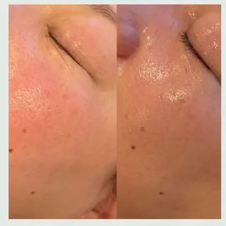 Florence  〜salon de nurse所属・Florence めぐみのエステ・リラクイメージ