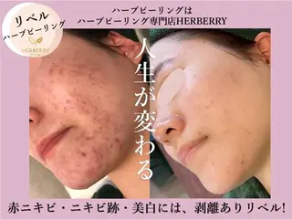 ハーブピーリング専門店HERBERRY難波心斎橋店所属・ハーブピーリング専門 HERBERRY冨永のエステ・リラクイメージ