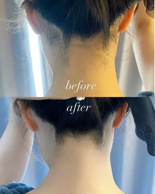 うなじ脱毛/美肌脱毛 LABELのエステ・リラクイメージ