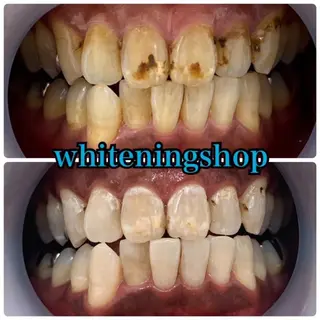 ホワイトニングショップ津店所属・ホワイトニング ショップ津店のその他イメージ