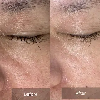 フェイシャルサロンKey of Face所属・村上 貴子のエステ・リラクイメージ