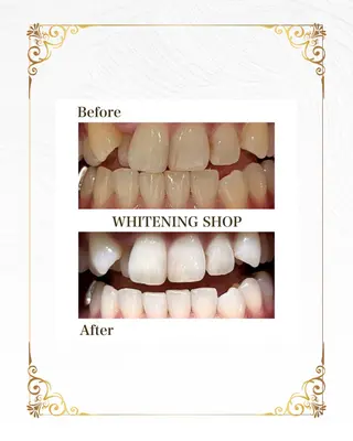 ホワイトニングショップ静岡葵区店所属・ホワイトニング ショップ葵区静岡駅店のその他イメージ