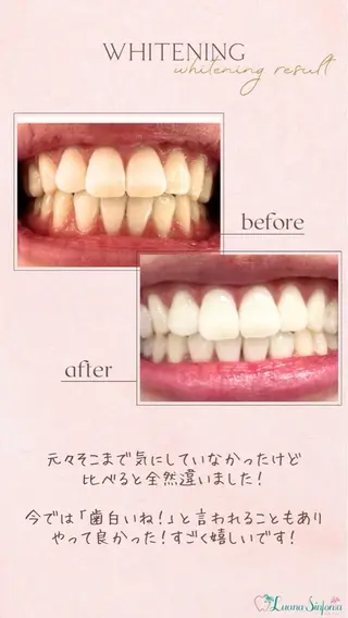 ホワイトニングサロンLuana-Sinfonia(エクシア)池袋店所属・セルフホワイトニング エクシア 池袋店のその他イメージ