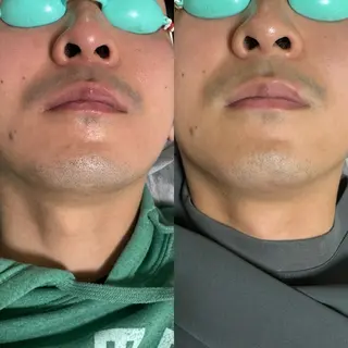 六本木脱毛andS 店長Sachiのエステ・リラクイメージ