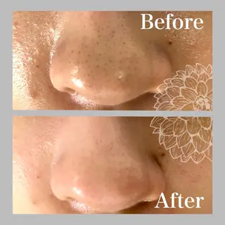 salon DAHLIA所属・salon DAHLIAのエステ・リラクイメージ