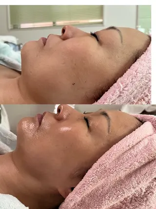 うえつま ふみえのエステ・リラクイメージ