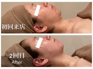 Ｂ&H所属・頭痛•肩こり専門/ 眉サロンB&H心斎橋のエステ・リラクイメージ