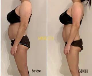 リンパマッサージ&ピラティスmimoza所属・リンパマッサージ mimozaのエステ・リラクイメージ