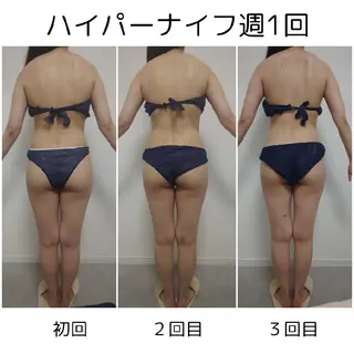 private salon TOWA所属・東洋✖️西洋痩身 TOWA♡関内馬車道のエステ・リラクイメージ