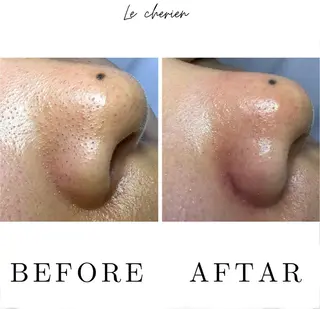 Le  cherien ル シェリア所属・毛穴洗浄/ハイフ サロンのエステ・リラクイメージ