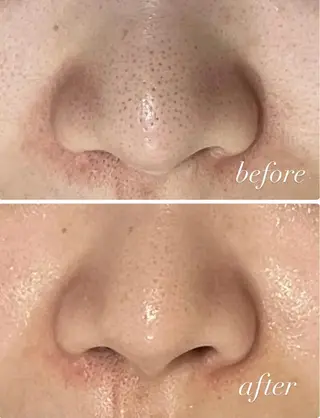 RAY Beauty エステ　一宮店のエステ・リラクイメージ