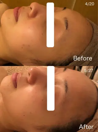 高岡⌇ Ayaka🌻のエステ・リラクイメージ