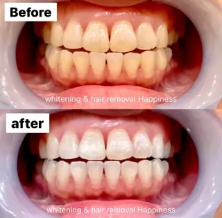 メンズ Happiness 広島並木通り店のその他イメージ