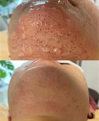 メンズ calimelo所属・calimero 美肌脱毛サロンの眉毛・アイブロウイメージ