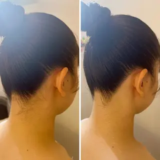 うなじ脱毛/美肌脱毛 LABELのエステ・リラクイメージ