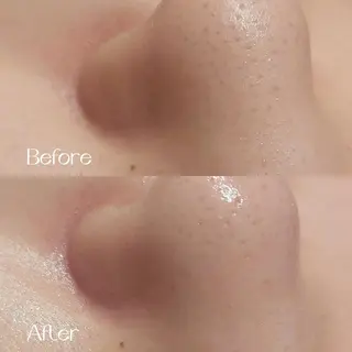 MyFairLady miuのエステ・リラクイメージ