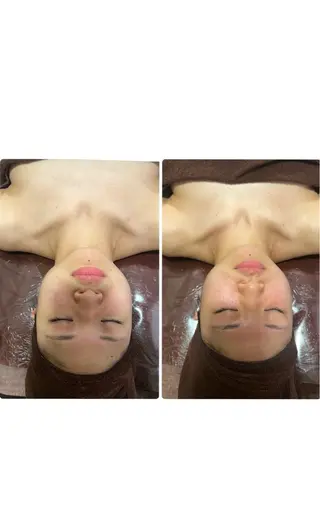 espresso,所属・《痩身、小顔専門店》 エスプレッソのエステ・リラクイメージ