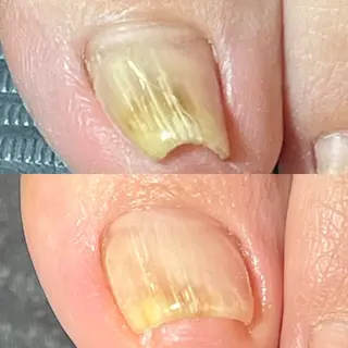 ネイル スカルプ専門店 Feelのネイルデザイン