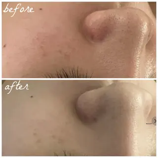 メンズ メナード岐阜茜部 杉浦のエステ・リラクイメージ