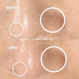 eyelash ×  eyebrow salon Non.所属・Non. NANASEのマツエク・マツパデザイン