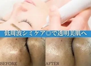 肌質改善サロン BestBelleのエステ・リラクイメージ