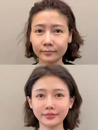 ネイル aliaハイフ&水光ジェットサロン所属・aliaハーブ水光店 エステティシャン募集のエステ・リラクイメージ