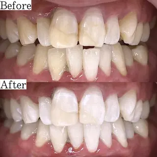 LBSホワイトニング 銀座店💎公式のその他イメージ