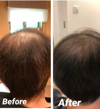 セレブリボーンパッシブタウン　プレミア所属・目澤 幸代のエステ・リラクイメージ