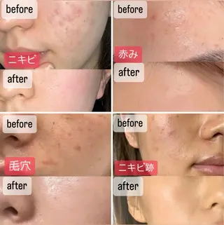 マツエク・マツパ 愛維美水光美肌専門店所属・愛維美水光美肌専門店 メンズレディースokのエステ・リラクイメージ