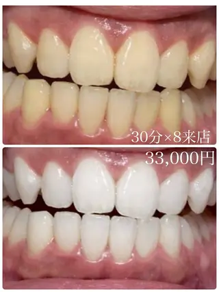 プラチナムビューティー柏所属・【歯科提携】柏ホワイ トニングスタイルのその他イメージ